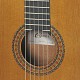 Cuenca 40-R Κλασσική Κιθάρα 4/4 Bundle